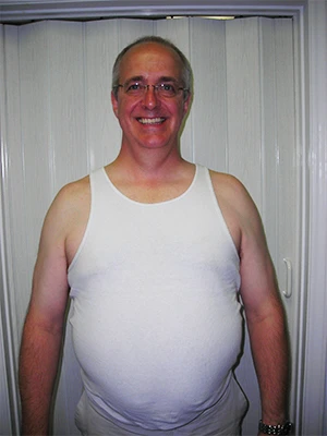 Weight Loss Cary NC Before